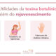 4 Utilidades da Toxina Botulínica além do rejuvenescimento